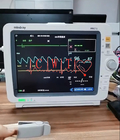 Reparatie van de de Multiparameter Geduldige Monitor van Imec12icu Mindray de Draagbare voor Volwassene