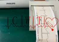 12.1in 1024x768 Philip XL het Gebruikte Defibrillator Gewicht van de Machineprinter 1.2KG